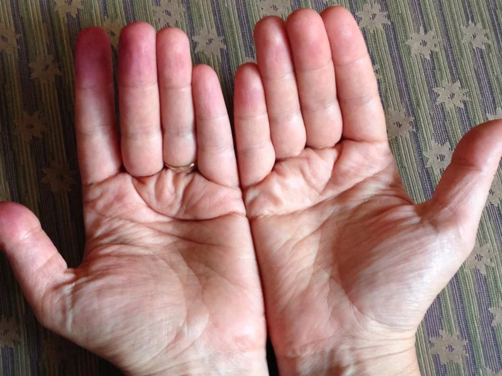 línea simiesca pliegue