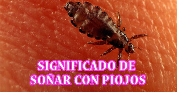 Que significa Soñar con piojos y liendres en la Cabeza